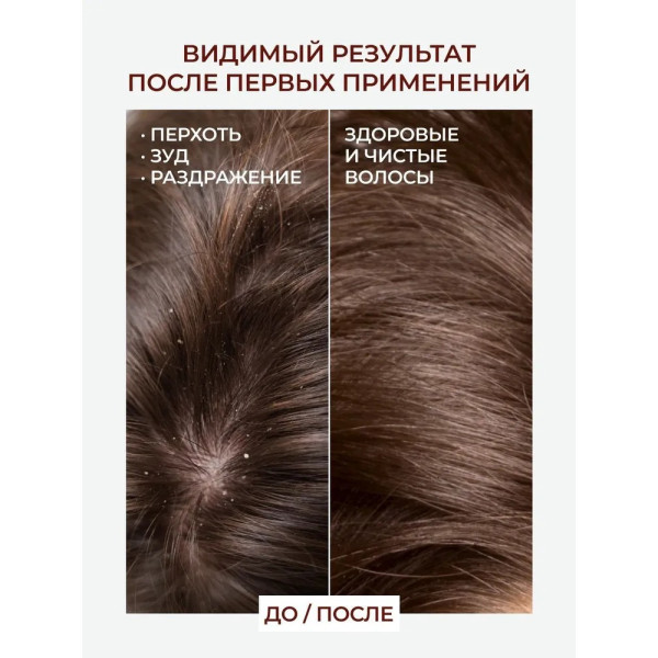 KULTA KORI Шампунь против перхоти и себореи на молочной сыворотке 250 мл